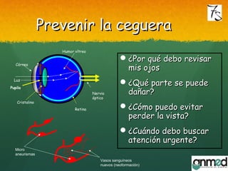 Prevenir la cegueraPrevenir la ceguera
¿Por qué debo revisar¿Por qué debo revisar
mis ojosmis ojos
¿Qué parte se puede¿Qué parte se puede
dañar?dañar?
¿Cómo puedo evitar¿Cómo puedo evitar
perder la vista?perder la vista?
¿Cuándo debo buscar¿Cuándo debo buscar
atención urgente?atención urgente?
Retina
Nervio
óptico
Córnea
Cristalino
Humor vítreo
Luz
Pupila
Micro
aneurismas
Vasos sanguíneos
nuevos (neoformación)
 