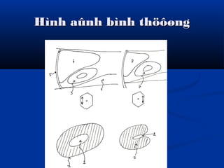 Hình aûnh bình thöôøngHình aûnh bình thöôøng
 