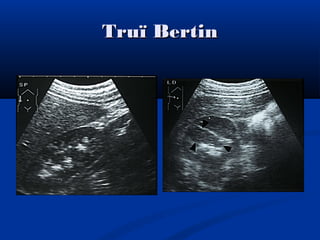 Truï BertinTruï Bertin
 