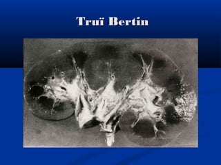 Truï BertinTruï Bertin
 