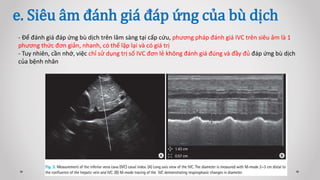 e. Siêu âm đánh giá đáp ứng của bù dịch
- Để đánh giá đáp ứng bù dịch trên lâm sàng tại cấp cứu, phương pháp đánh giá IVC trên siêu âm là 1
phương thức đơn giản, nhanh, có thể lặp lại và có giá trị
- Tuy nhiên, cần nhớ, việc chỉ sử dụng trị số IVC đơn lẻ không đánh giá đúng và đầy đủ đáp ứng bù dịch
của bệnh nhân
 