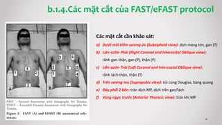 b.1.4.Các mặt cắt của FAST/eFAST protocol
Các mặt cắt cần khảo sát:
a) Dưới mũi kiếm xương ức (Subxiphoid view): dịch màng tim, gan (T)
b) Liên sườn Phải (Right Coronal and Intercostal Oblique view):
rãnh gan-thận, gan (P), thận (P)
c) Liên sườn Trái (Left Coronal and Intercostal Oblique view):
rãnh lách-thận, thận (T)
d) Trên xương mu (Suprapubic view): túi cùng Douglas, bàng quang
e) Đáy phổi 2 bên: tràn dịch MP, dịch trên gan/lách
f) Vùng ngực trước (Anterior Thoracic view): tràn khí MP
 