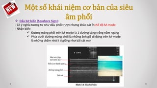  Dấu bờ biển (Seashore Sign):
- Có ý nghĩa tương tự như dấu phổi trượt nhưng khảo sát ở chế độ M-mode
- Nhận biết:
 Đường màng phổi trên M-mode là 1 đường sáng trắng nằm ngang
 Phía dưới đường màng phổi là những ảnh giả di động trên M-mode
là những chấm nhỏ li ti giống như bãi cát mịn
Một số khái niệm cơ bản của siêu
âm phổi
 