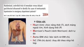  Khảo sát:
• Heart (tim): chức năng thất (T), dịch màng
ngoài tim, hình dạng thất (P)
• Morrison’s Pouch (rãnh Morrison): dịch tự
do
• Aorta (ĐM chủ): bóc tách/vỡ ĐM chủ
• IVC (TM chủ dưới): thay đổi theo nhịp hô
hấp
 