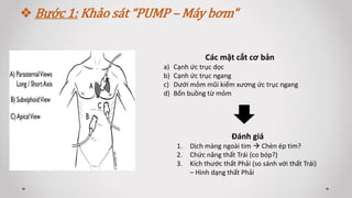  Bước 1: Khảo sát “PUMP – Máy bơm”
Các mặt cắt cơ bản
a) Cạnh ức trục dọc
b) Cạnh ức trục ngang
c) Dưới mỏm mũi kiếm xương ức trục ngang
d) Bốn buồng từ mỏm
Đánh giá
1. Dịch màng ngoài tim  Chèn ép tim?
2. Chức năng thất Trái (co bóp?)
3. Kích thước thất Phải (so sánh với thất Trái)
– Hình dạng thất Phải
 