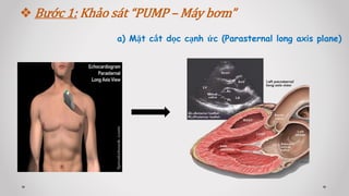 a) Mặt cắt dọc cạnh ức (Parasternal long axis plane)
 Bước 1: Khảo sát “PUMP – Máy bơm”
 