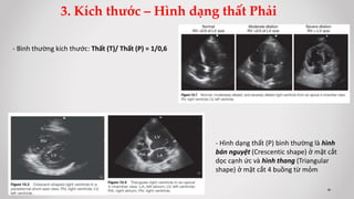 3. Kích thước – Hình dạng thất Phải
- Bình thường kích thước: Thất (T)/ Thất (P) = 1/0,6
- Hình dạng thất (P) bình thường là hình
bán nguyệt (Crescentic shape) ở mặt cắt
dọc cạnh ức và hình thang (Triangular
shape) ở mặt cắt 4 buồng từ mỏm
 