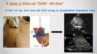  Bước 2: Khảo sát “TANK – Bể chứa”
a) Mặt cắt dọc dưới mỏm mũi kiếm xương ức (Longitudinal Supxiphoid view)
 