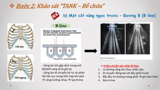 Bước 2: Khảo sát “TANK – Bể chứa”
b) Mặt cắt vùng ngực trước – Đường B (B line)
Cắt dọc
Cắt ngang
B-line
- Sóng âm khi gặp dịch trong mô
kẽ/phế nang sẽ bị giữ lại
- Sóng âm di chuyển tới lui và phản
hồi liên tục trong hỗn hợp khí-dịch
 cộng hưởng nhau  tạo B-line
 4 tiêu chuẩn xác nhận B-line:
1. Là đường tăng âm theo chiều dọc
2. Di chuyển đồng bộ với dấu phổi trượt
3. Bắt đầu từ đường màng phổi  gờ màn hình
4. Xóa A-line
 