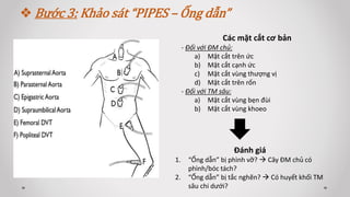  Bước 3: Khảo sát “PIPES – Ống dẫn”
Các mặt cắt cơ bản
- Đối với ĐM chủ:
a) Mặt cắt trên ức
b) Mặt cắt cạnh ức
c) Mặt cắt vùng thượng vị
d) Mặt cắt trên rốn
- Đối với TM sâu:
a) Mặt cắt vùng bẹn đùi
b) Mặt cắt vùng khoeo
Đánh giá
1. “Ống dẫn” bị phình vỡ?  Cây ĐM chủ có
phình/bóc tách?
2. “Ống dẫn” bị tắc nghẽn?  Có huyết khối TM
sâu chi dưới?
 