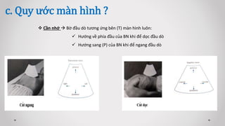 c. Quy ước màn hình ?
 Cần nhớ  Bờ đầu dò tương ứng bên (T) màn hình luôn:
 Hướng về phía đầu của BN khi để dọc đầu dò
 Hướng sang (P) của BN khi để ngang đầu dò
 