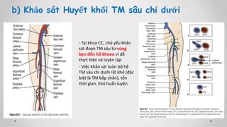 b) Khảo sát Huyết khối TM sâu chi dưới
- Tại khoa CC, chủ yếu khảo
sát đoạn TM sâu từ vùng
bẹn đến hố khoeo vì dễ
thực hiện và luyện tập
- Việc khảo sát toàn bộ hệ
TM sâu chi dưới rất khó (đặc
biệt là TM bắp chân), tốn
thời gian, khó huấn luyện
 