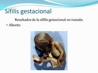 Sífilis gestacional
    Resultados de la sífilis gestacional no tratada:
 Aborto
 