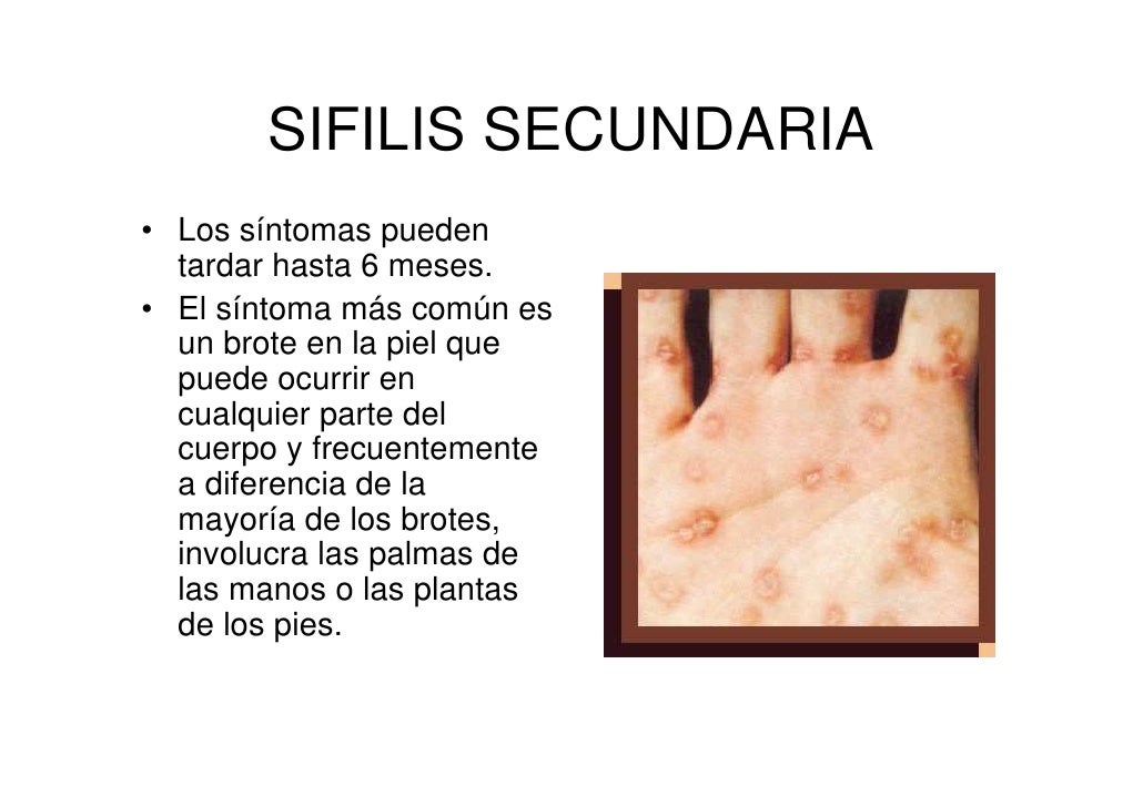 Como curar los cabellos de la caída del adolescente