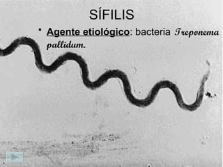 SÍFILIS
• Agente etiológico: bacteria Treponema
pallidum.
 