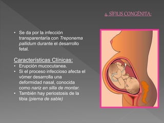 4. SÍFILIS CONGÉNITA: 
• Se da por la infección 
transparentaría con Treponema 
pallidum durante el desarrollo 
fetal. 
Características Clínicas: 
• Erupción mucocutanea. 
• Si el proceso infeccioso afecta el 
vómer desarrolla una 
deformidad nasal, conocida 
como nariz en silla de montar. 
• También hay periostosis de la 
tibia (pierna de sable) 
 