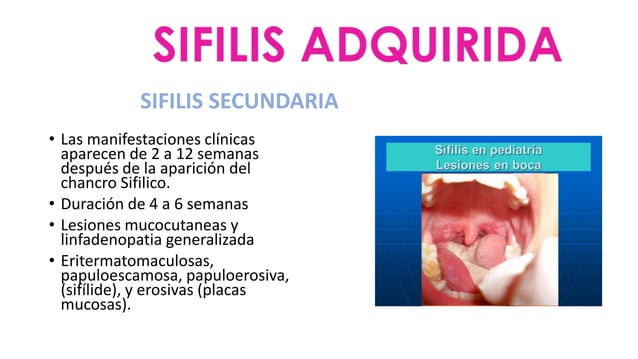 sifilis-enfermedades-de-transmision-sexual-ppt
