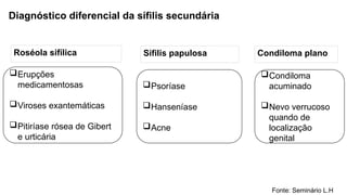 Diagnóstico diferencial da sífilis secundária
Roséola sifílica Sífilis papulosa Condiloma plano
Erupções
medicamentosas
Viroses exantemáticas
Pitiríase rósea de Gibert
e urticária
Psoríase
Hanseníase
Acne
Condiloma
acuminado
Nevo verrucoso
quando de
localização
genital
Fonte: Seminário L.H
 