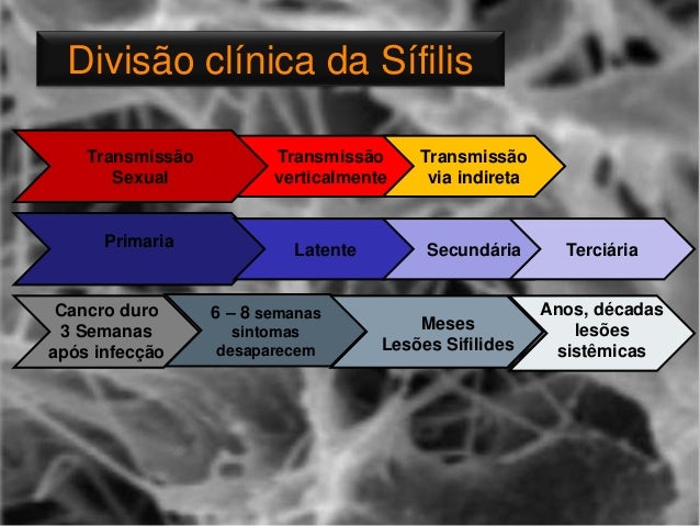 Exame de vdrl