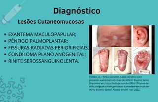 Sífilis congênita .pdf