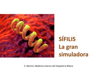 SÍFILIS
La gran
simuladora
C. Merino. Medicina interna-UEI Hospital la Ribera
 