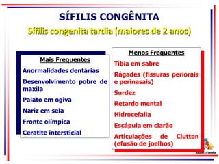 SÍFILIS CONGÊNITA
Sífilis congenita tardia (maiores de 2 anos)
Menos Frequentes
Tíbia em sabre
Rágades (fissuras periorais
e perinasais)
Surdez
Retardo mental
Hidrocefalia
Escápula em clarão
Articulações de Clutton
(efusão de joelhos)
Mais Frequentes
Anormalidades dentárias
Desenvolvimento pobre de
maxila
Palato em ogiva
Nariz em sela
Fronte olímpica
Ceratite intersticial
 