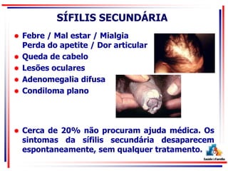SÍFILIS SECUNDÁRIA
 Febre / Mal estar / Mialgia
Perda do apetite / Dor articular
 Queda de cabelo
 Lesões oculares
 Adenomegalia difusa
 Condiloma plano
 Cerca de 20% não procuram ajuda médica. Os
sintomas da sífilis secundária desaparecem
espontaneamente, sem qualquer tratamento.
 