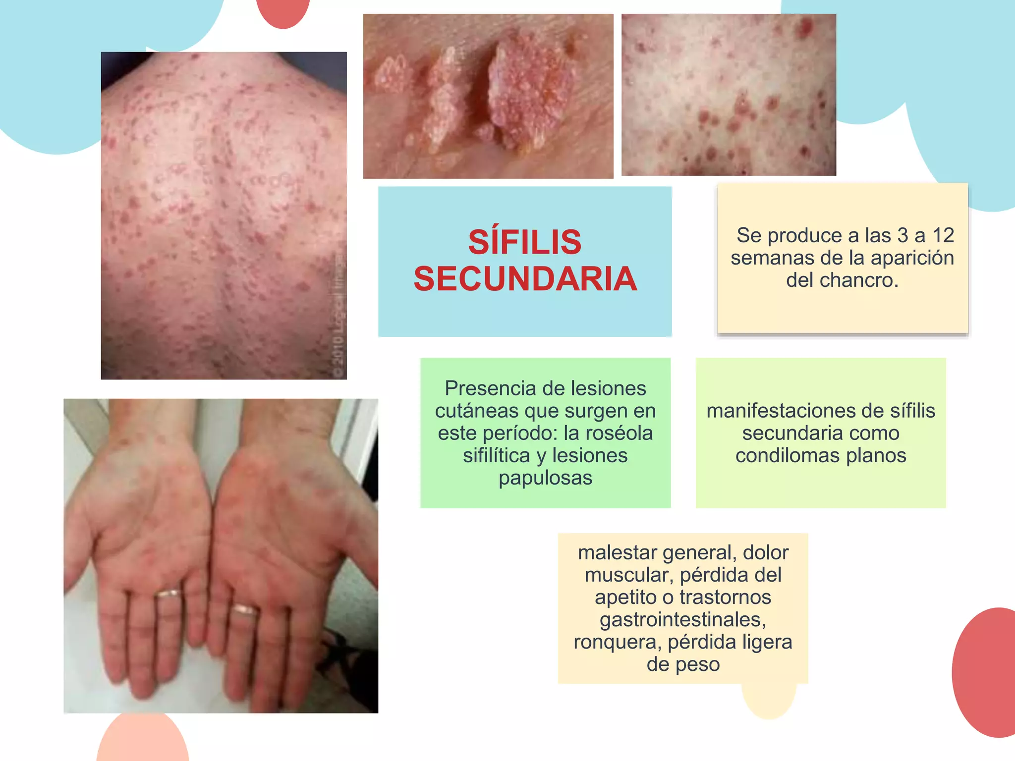 SIFILIS Y EMBARAZO- RAFAEL MARRUGO..pptx