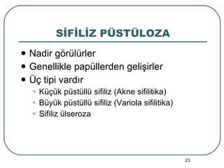 SİFİLİZ PÜSTÜLOZA Nadir görülürler Genellikle papüllerden gelişirler Üç tipi vardır Küçük püstüllü sifiliz (Akne sifilitika) Büyük püstüllü sifiliz (Variola sifilitika) Sifiliz ülseroza 