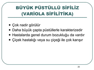 BÜYÜK PÜSTÜLLÜ SİFİLİZ (VARİOLA SİFİLİTİKA) Çok nadir görülür Daha büyük çapta püstüllerle karakterizedir Hastalarda genel durum bozukluğu da vardır Çiçek hastalığı veya su çiçeği ile çok karışır 