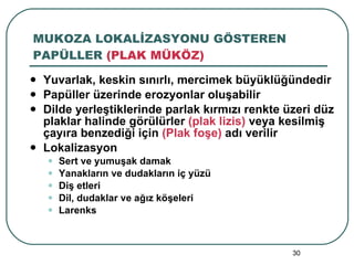 MUKOZA LOKALİZASYONU GÖSTEREN PAPÜLLER  (PLAK MÜKÖZ) Yuvarlak, keskin sınırlı, mercimek büyüklüğündedir Papüller üzerinde erozyonlar oluşabilir Dilde yerleştiklerinde parlak kırmızı renkte üzeri düz plaklar halinde görülürler  (plak lizis)  veya kesilmiş çayıra benzediği için  (Plak foşe)  adı verilir Lokalizasyon Sert ve yumuşak damak Yanakların ve dudakların iç yüzü Diş etleri Dil, dudaklar ve ağız köşeleri Larenks 