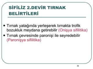 SİFİLİZ 2.DEVİR TIRNAK BELİRTİLERİ Tırnak yatağında yerleşerek tırnakta trofik bozukluk meydana getirebilir  (Onişya sifilitika) Tırnak çevresinde paronişi ile seyredebilir  (Paronişya sifilitika) 