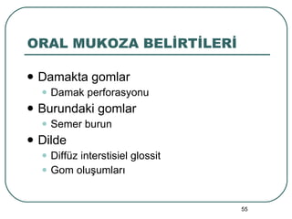 ORAL MUKOZA BELİRTİLERİ Damakta gomlar Damak perforasyonu Burundaki gomlar Semer burun Dilde Diffüz interstisiel glossit Gom oluşumları 