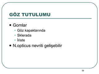 GÖZ TUTULUMU Gomlar Göz kapaklarında Sklerada İriste N.opticus nevriti gelişebilir 