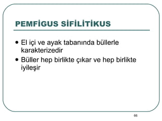 PEMFİGUS SİFİLİTİKUS El içi ve ayak tabanında büllerle karakterizedir Büller hep birlikte çıkar ve hep birlikte iyileşir 