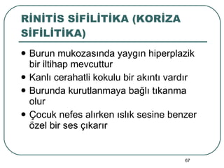 RİNİTİS SİFİLİTİKA (KORİZA SİFİLİTİKA) Burun mukozasında yaygın hiperplazik bir iltihap mevcuttur Kanlı cerahatli kokulu bir akıntı vardır Burunda kurutlanmaya bağlı tıkanma olur Çocuk nefes alırken ıslık sesine benzer özel bir ses çıkarır 