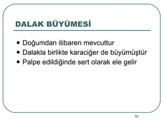 DALAK BÜYÜMESİ Doğumdan itibaren mevcuttur Dalakla birlikte karaciğer de büyümüştür Palpe edildiğinde sert olarak ele gelir 