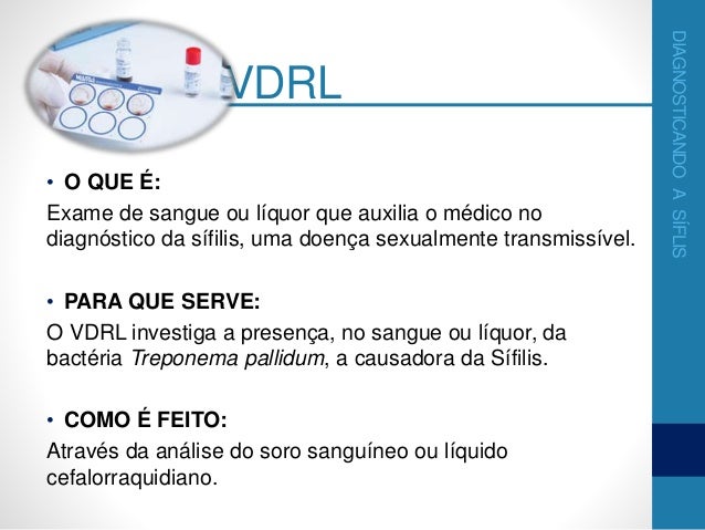 Exame de sangue fta abs