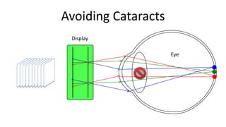 Avoiding Cataracts
 Display

                     Eye
 