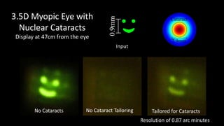 3.5D Myopic Eye with




                                    0.9mm
                                                               Cataract
  Nuclear Cataracts
Display at 47cm from the eye
                                                               7.9mm
                                        Input
                                                              p = 20mm




       No Cataracts       No Cataract Tailoring       Tailored for Cataracts
                                                  Resolution of 0.87 arc minutes
 