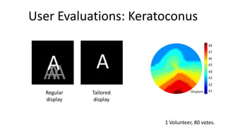 User Evaluations: Keratoconus
                                             48
                                             47



  A
  AA
  A          A                               46
                                             45
                                             44
                                             43
                                             42
                                             41
  Regular   Tailored              Diopters

  display    display



                       1 Volunteer, 80 votes.
 