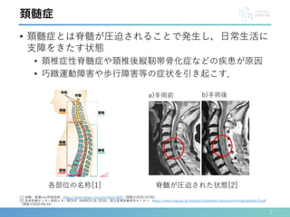 • 頚髄症とは脊髄が圧迫されることで発生し，日常生活に
支障をきたす状態
• 頚椎症性脊髄症や頚椎後縦靭帯骨化症などの疾患が原因
• 巧緻運動障害や歩行障害等の症状を引き起こす．
2
[1] 脊髄，看護roo!用語辞典，https://www.kango-roo.com/word/5025（閲覧日2020/10/06）
[2] 長寿医療センター病院レター第25号（MARCH 26, 2010)，国立長寿医療研究センター，https://www.ncgg.go.jp/hospital/iryokankei/documents/hospitalletter25.pdf
（閲覧日2020/09/24）
頚髄症
脊髄が圧迫された状態[2]
a)手術前 b)手術後
各部位の名称[1]
 