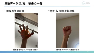 • 模擬患者の映像
16
実験データ (2/3) ：映像の一例
• 患者 & 健常者の映像
模擬患者のグーパー運動の様子 健常者のグーパー運動の様子
 
