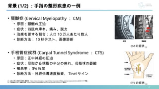 2
• 頸髄症 (Cervical Myelopathy ： CM)
• 原因：頸髄の圧迫
• 症状：四肢の痺れ、痛み、脱力
• 治療を要する割合：人口 10 万人あたり数人
• 診断方法： 10 秒テスト、画像診断
• 手根管症候群 (Carpal Tunnel Syndrome ： CTS)
• 原因：正中神経の圧迫
• 症状：母指から環指の半分の痺れ、母指球の萎縮
• 罹患率： 3% 程度
• 診断方法：神経伝導速度検査、 Tinel サイン
背景 (1/2) ：手指の整形疾患の一例
[1] 北里大学北里研究所病院 頸髄症 , https://www.kitasato-u.ac.jp/hokken-hp/visitor/office_visit/cervicalcord.html (2024/1/17 閲覧 )
[2] 三鷹整形外科 手根管症候群 , https://www.mitakaseikei.com/carpal_tunnel/ (2024/1/17 閲覧 )
CTS の症状 [2]
CM の症状 [1]
 