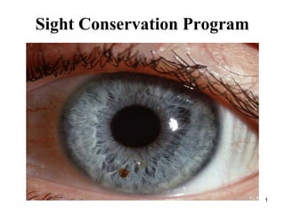 1
Sight Conservation Program
 