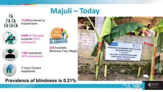Majuli – Today
13,090 screened by
hospital team
4,649 (8,742 eyes)
surgeries (73%
conversion)
7,885 spectacles
(67% conversion)
2 Vision Centers
established
220 Avoidable
Blindness Free Villages
Prevalence of blindness is 0.21%
 