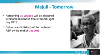 Majuli - Tomorrow
• Remaining 76 villages will be declared
avoidable blindness free in World Sight
day 2018
• Entire Island/ district will be declared
ABF by the end of Dec 2018
 