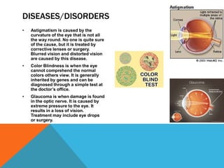 DISEASES/DISORDERS
•

Astigmatism is caused by the
curvature of the eye that is not all
the way round. No one is quite sure
of the cause, but it is treated by
corrective lenses or surgery.
Blurred vision and distorted vision
are caused by this disease.

•

Color Blindness is when the eye
cannot comprehend the normal
colors others view. It is generally
inherited by genes and can be
diagnosed through a simple test at
the doctor’s office.

•

Glaucoma is when damage is found
in the optic nerve. It is caused by
extreme pressure to the eye. It
results in a loss of vision.
Treatment may include eye drops
or surgery.

 
