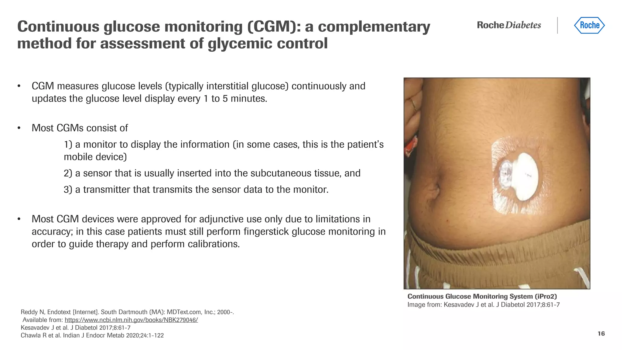 16
• CGM measures glucose levels (typically interstitial glucose) continuously and
updates the glucose level display every 1 to 5 minutes.
• Most CGMs consist of
1) a monitor to display the information (in some cases, this is the patient’s
mobile device)
2) a sensor that is usually inserted into the subcutaneous tissue, and
3) a transmitter that transmits the sensor data to the monitor.
• Most CGM devices were approved for adjunctive use only due to limitations in
accuracy; in this case patients must still perform fingerstick glucose monitoring in
order to guide therapy and perform calibrations.
Continuous glucose monitoring (CGM): a complementary
method for assessment of glycemic control
Reddy N, Endotext [Internet]. South Dartmouth (MA): MDText.com, Inc.; 2000-.
Available from: https://www.ncbi.nlm.nih.gov/books/NBK279046/
Kesavadev J et al. J Diabetol 2017;8:61-7
Chawla R et al. Indian J Endocr Metab 2020;24:1-122
Continuous Glucose Monitoring System (iPro2)
Image from: Kesavadev J et al. J Diabetol 2017;8:61-7
 