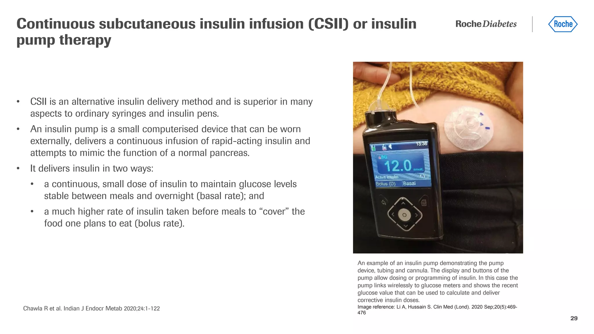 29
• CSII is an alternative insulin delivery method and is superior in many
aspects to ordinary syringes and insulin pens.
• An insulin pump is a small computerised device that can be worn
externally, delivers a continuous infusion of rapid-acting insulin and
attempts to mimic the function of a normal pancreas.
• It delivers insulin in two ways:
• a continuous, small dose of insulin to maintain glucose levels
stable between meals and overnight (basal rate); and
• a much higher rate of insulin taken before meals to “cover” the
food one plans to eat (bolus rate).
Continuous subcutaneous insulin infusion (CSII) or insulin
pump therapy
Chawla R et al. Indian J Endocr Metab 2020;24:1-122
An example of an insulin pump demonstrating the pump
device, tubing and cannula. The display and buttons of the
pump allow dosing or programming of insulin. In this case the
pump links wirelessly to glucose meters and shows the recent
glucose value that can be used to calculate and deliver
corrective insulin doses.
Image reference: Li A, Hussain S. Clin Med (Lond). 2020 Sep;20(5):469-
476
 